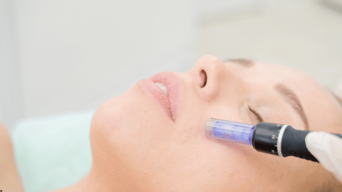Närbild på ansikte under microneedling-behandling hemma med elektrisk dermapen mot kinden, fokus på hudstruktur och nålhuvud i kontakt med huden.