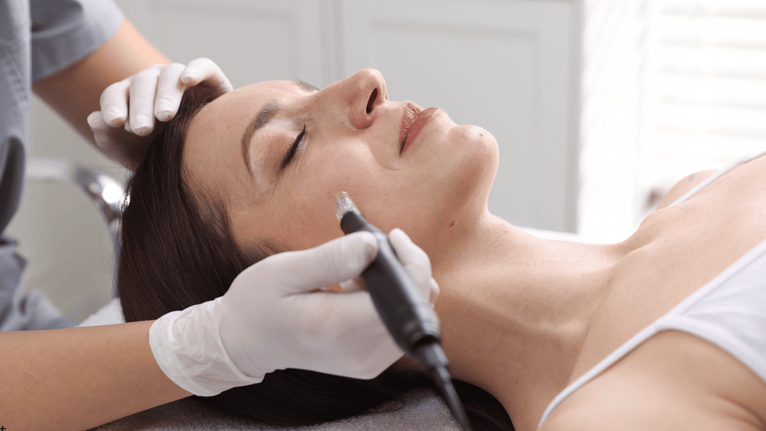 Så väljer du rätt microneedling-penna