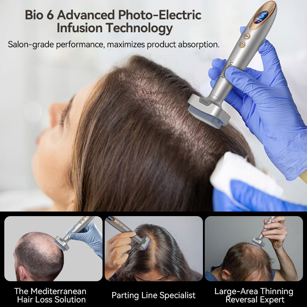 Bio Pen Bio 6 wird bei der Behandlung von Haarausfall mit fortschrittlicher photo-elektrischer Infusionstechnologie verwendet, zeigt professionelle Anwendung zur Stimulierung des Haarwachstums und Verbesserung der Produktabsorption auf dünnhaarigen Bereichen.