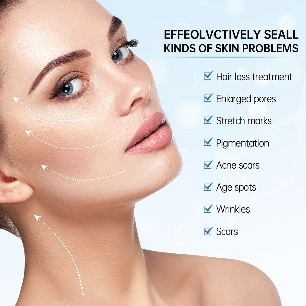 Frau zeigt das Ergebnis von microneedling zur Behandlung von Hautproblemen wie großen Poren, Narben, Aknenarben, Pigmentflecken, Falten und feinen Linien.